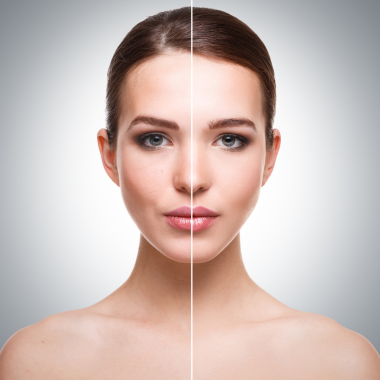 Plastic Surgery